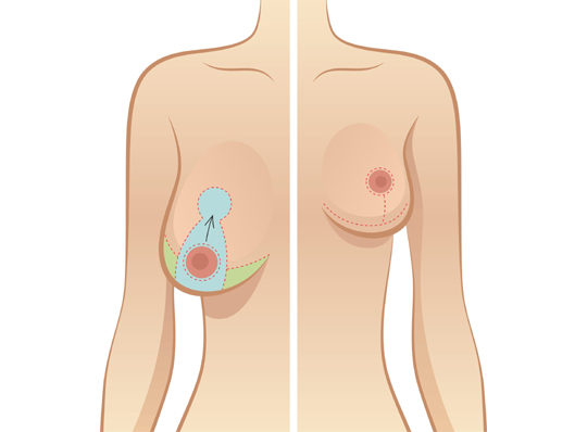Best Cosmetic and Plastic Surgeon in Meerut