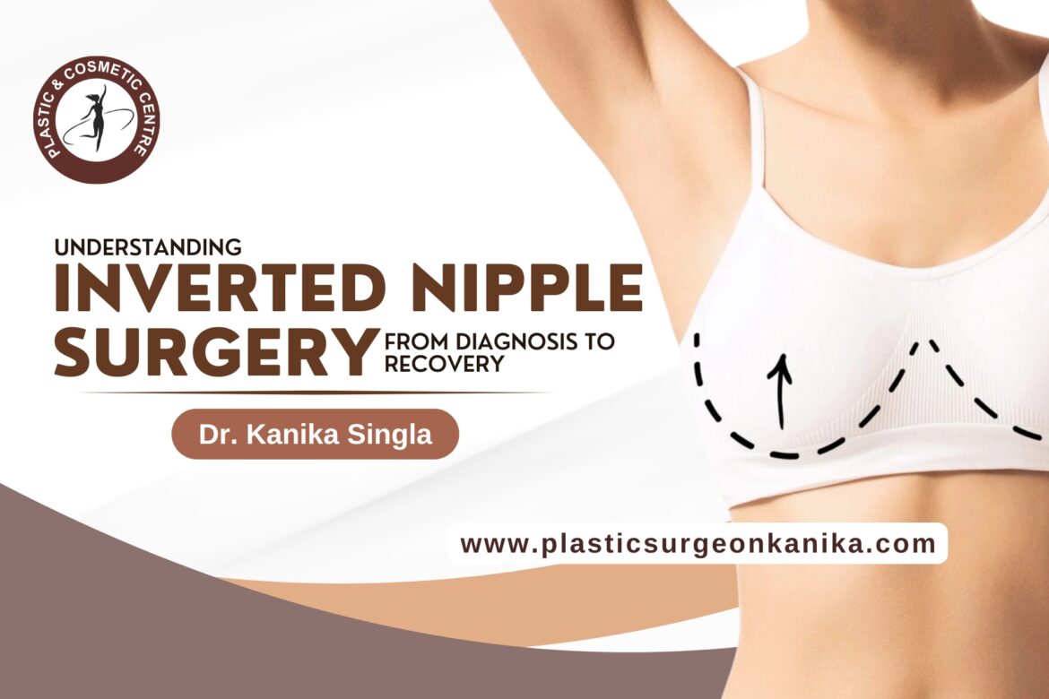 Inverted Nipple Surgery