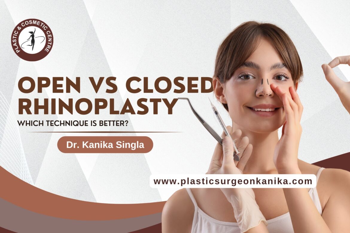 Rhinoplasty surgery