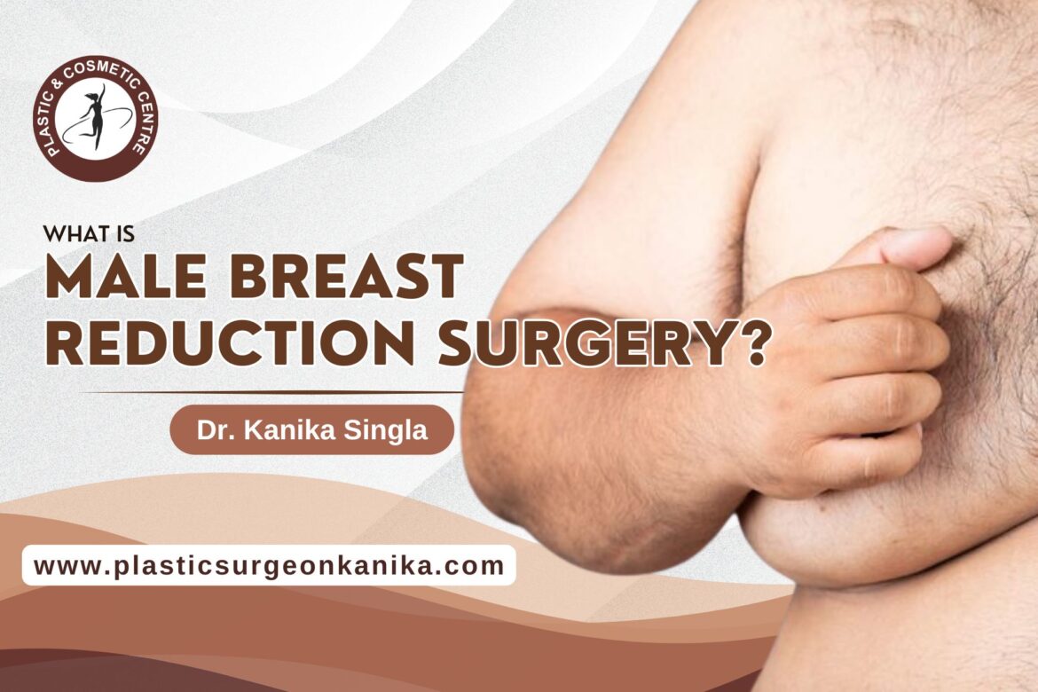 Male Breast Reduction Surgery