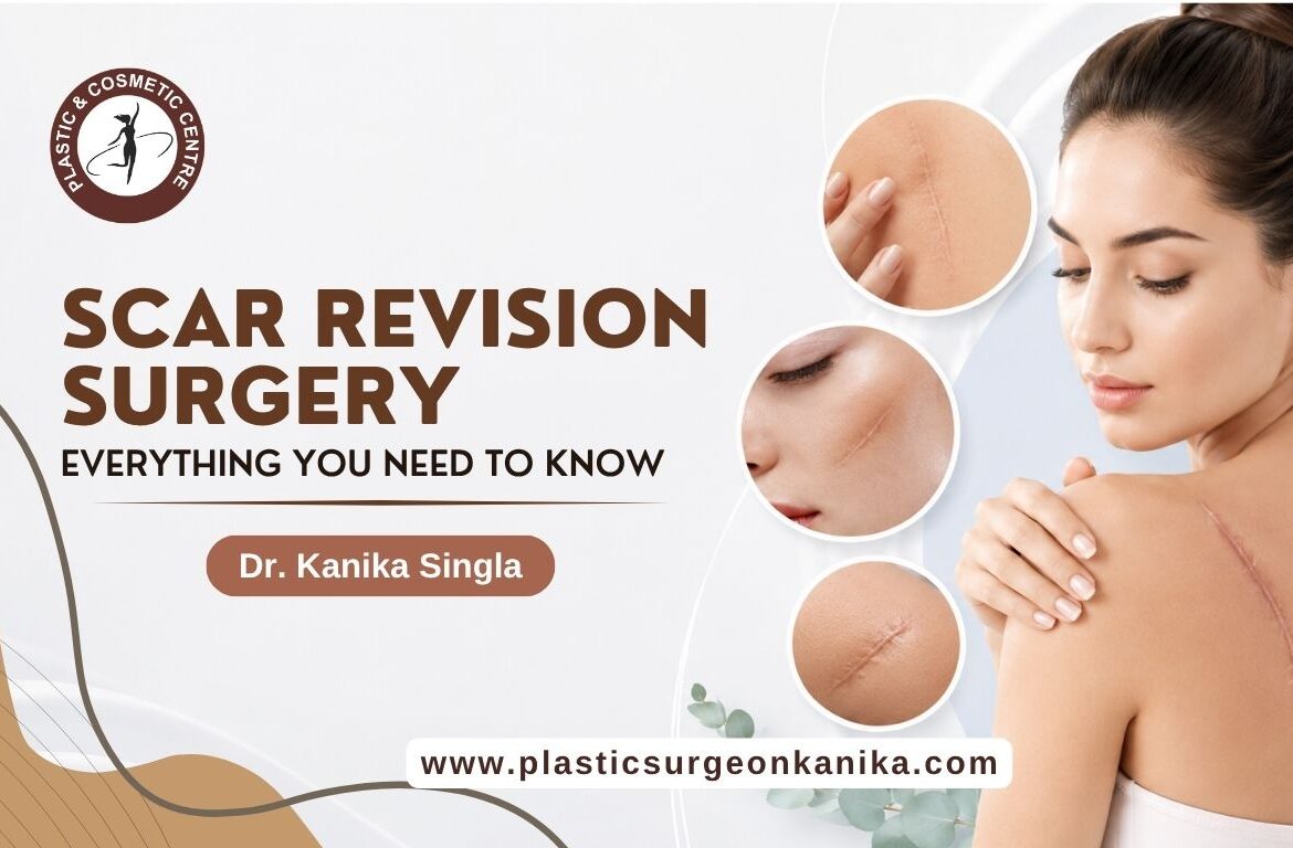 Scar Revision Surgery